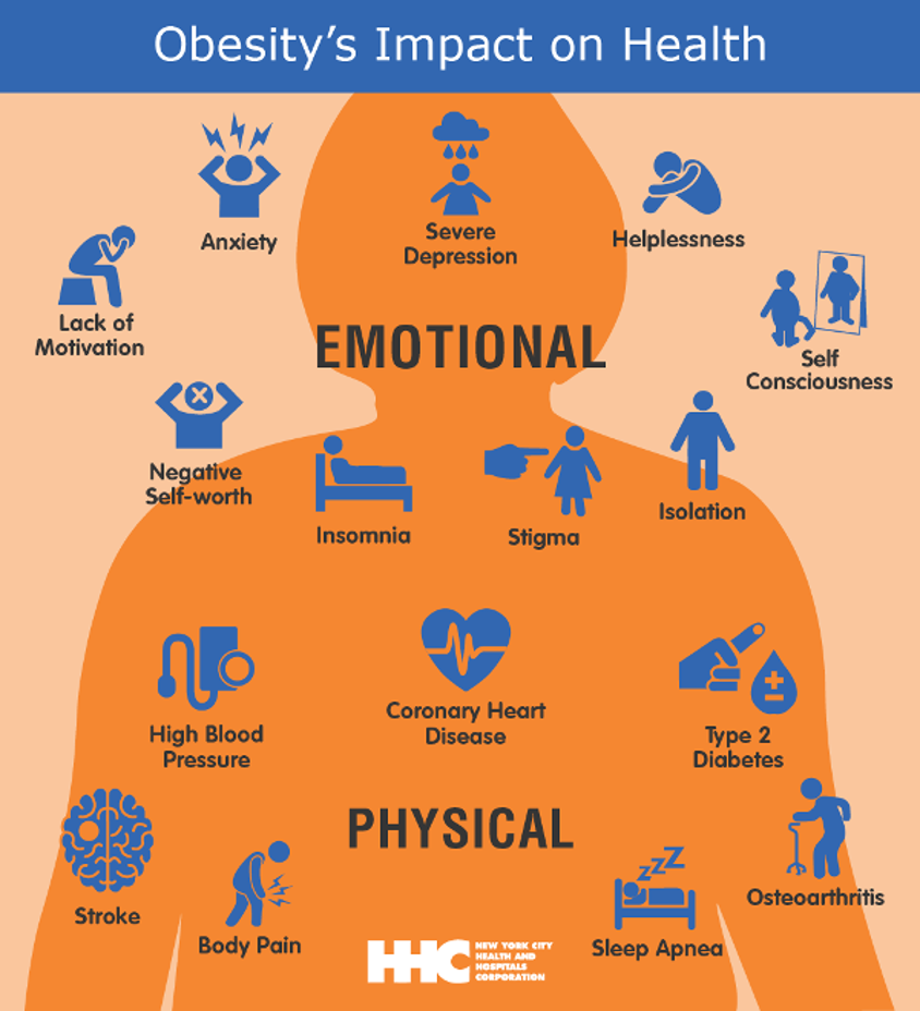 Image result for obesity and depression